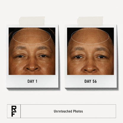 RODAN + FIELDS Redefine Overnight Restorative Cream – Step 3 PM Night Moisturizer with Glycolic Acid & Bakuchiol