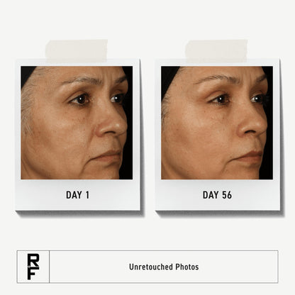 RODAN + FIELDS Total RF Serum 30 mL | Hydration & Fine Line Targeting for Women