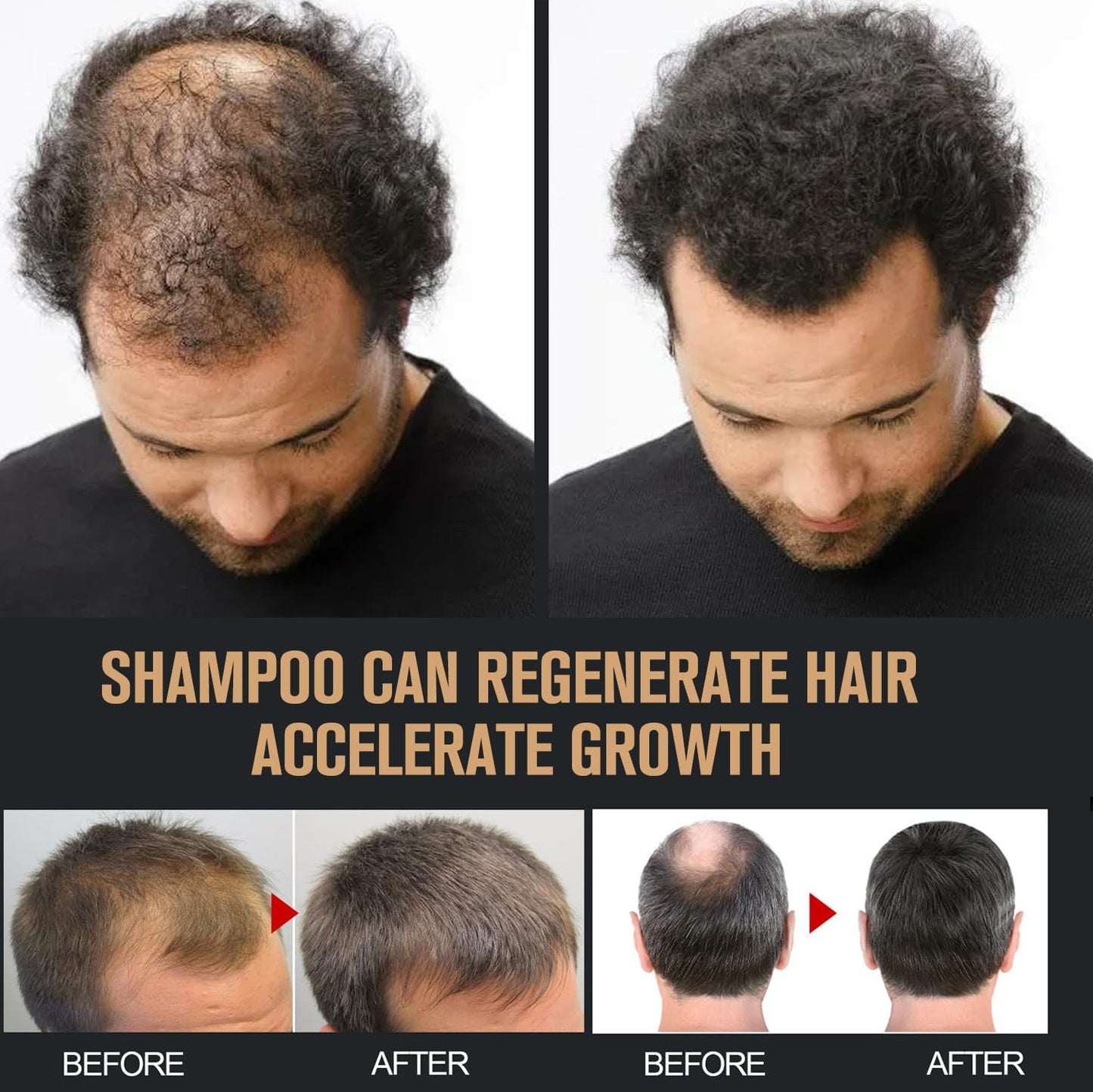2 Pcs Root Activator Shampoo – Hair Growth Root Activator Shampoo for Anti-Hair Loss | Natural Formula for Men & Women