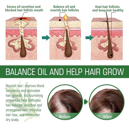 Rosemary Oil for Hair Growth & Treatment – 60 ml / 2.2 fl oz Dropper Bottle Pack (2 Units)