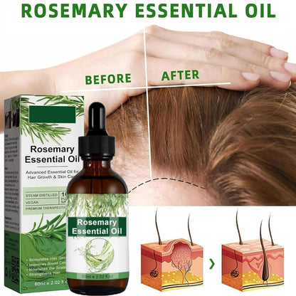 Rosemary Oil for Hair Growth & Treatment – 60 ml / 2.2 fl oz Dropper Bottle Pack (2 Units)