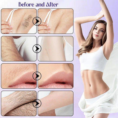 ROSINO Coconut Oil Facial Hair Removal Cream for Women | Gentle, Natural Depilatory Cream