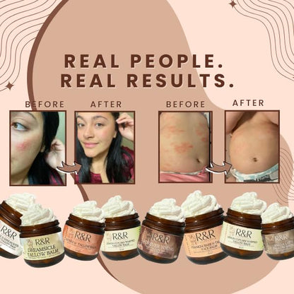 R&R Collective Vanilla Latte Tallow Face Moisturizer – Grass-Fed Beef Tallow Balm with Coffee & Vanilla for Dry & Sensitive Skin