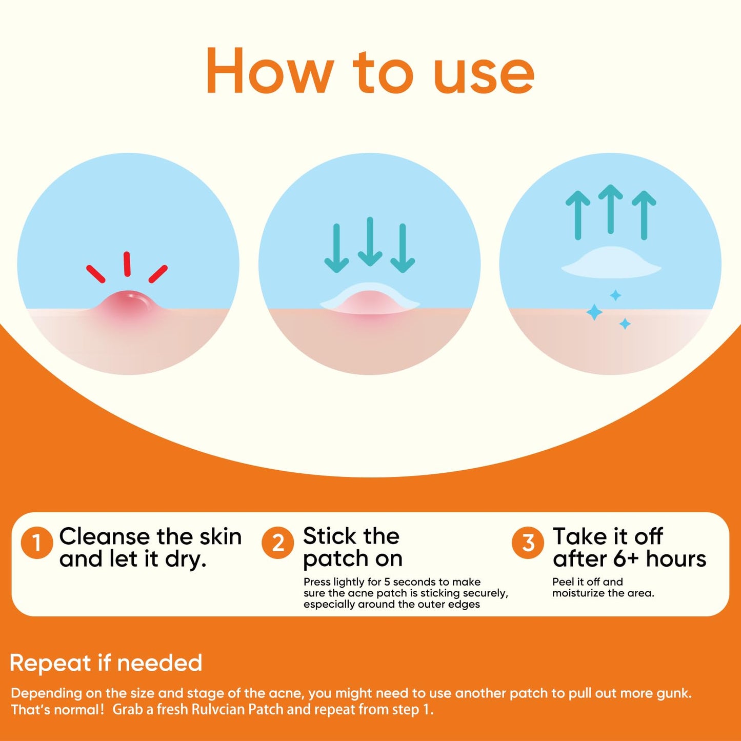 Rulvcian Microdart Acne Patches & Salicylic Acid Pimple Patches | Fast Zit Care