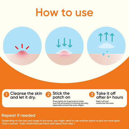 Rulvcian Microdart Acne Patches & Salicylic Acid Pimple Patches | Fast Zit Care