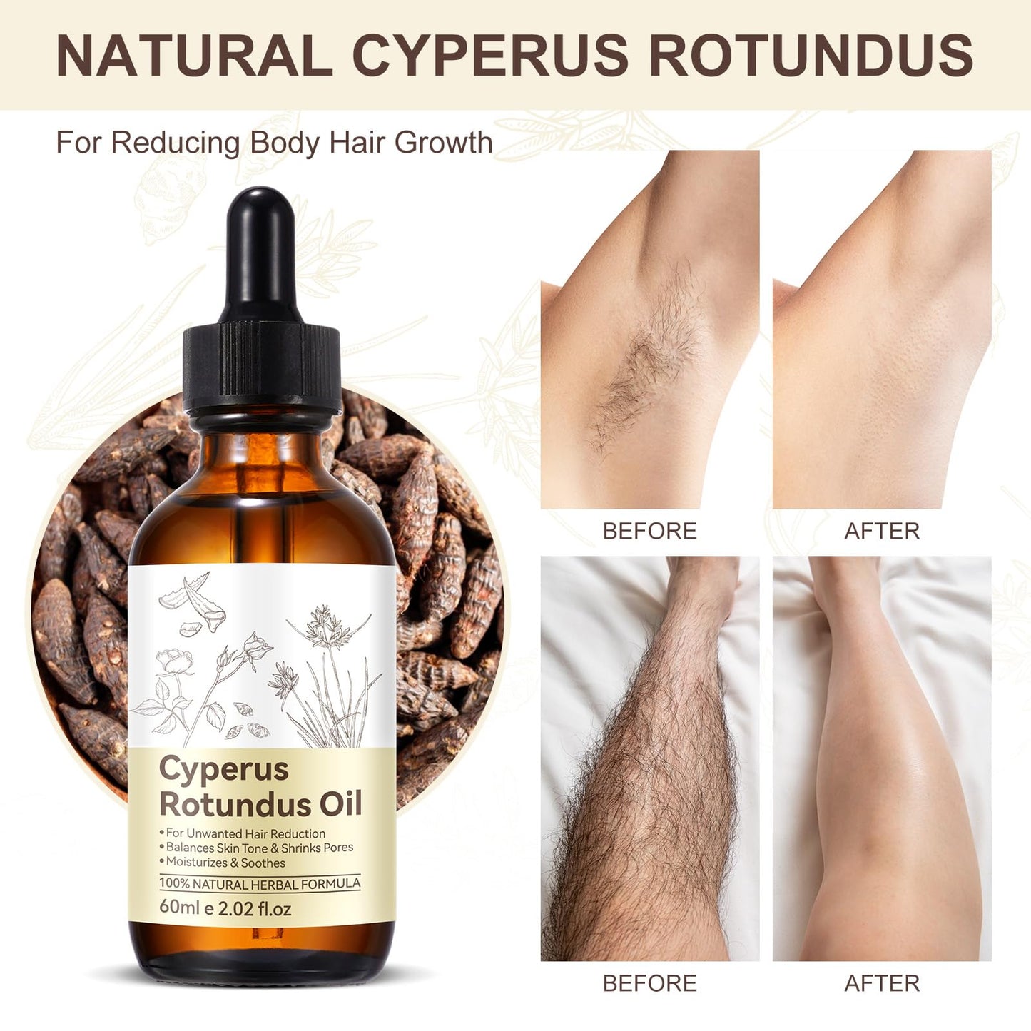 Rulviou 2 Pack Cyperus Rotundus Oil for Hair Removal – Gentle Natural Body Hair Growth Reducer, 4 fl oz