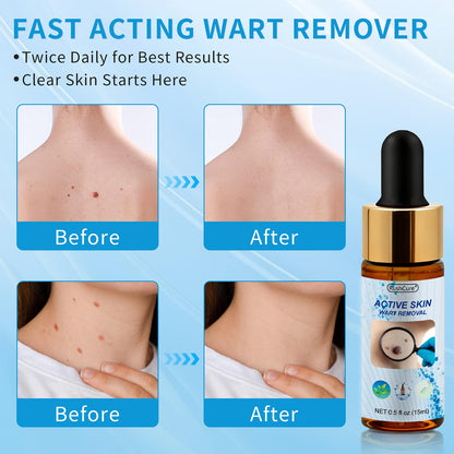 RushCure Wart Remover Serum — 17% Salicylic, Precision Dropper, Travel Size 0.5 oz