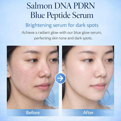 Salmon DNA PPRN Serum – 5000ppm PDRN, 6 Hyaluronic Acids, Niacinamide & Glutathione, Korean Anti-Aging