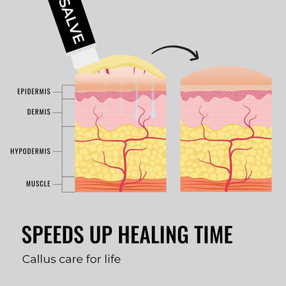 SandBar Natural Callus Salve – Revitalizing Balm for Calluses | On-The-Go Care