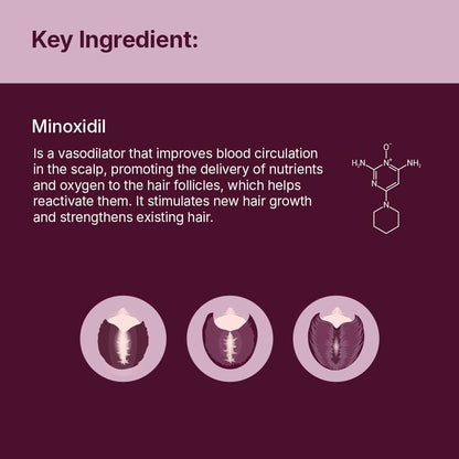Santo Remedio Women’s Hair Regrowth Treatment – 2% Minoxidil, Fragrance-Free, 1-Month Supply