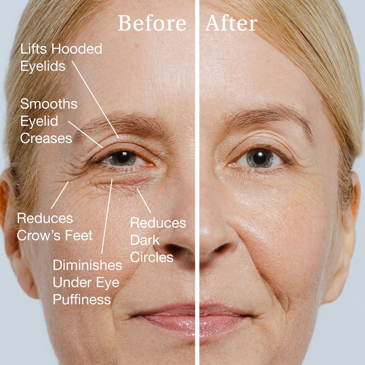 SBLA Eye Lift Wand – Anti-Aging Serum for Eyelids & Eye Area | SBLA66Peptide™, Caffeine, Hyaluronic Acid