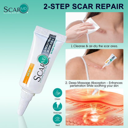 ScarMD Silicone Scar Gel – Roll-On Scar Cream for Surgical, Acne & Keloid Scars