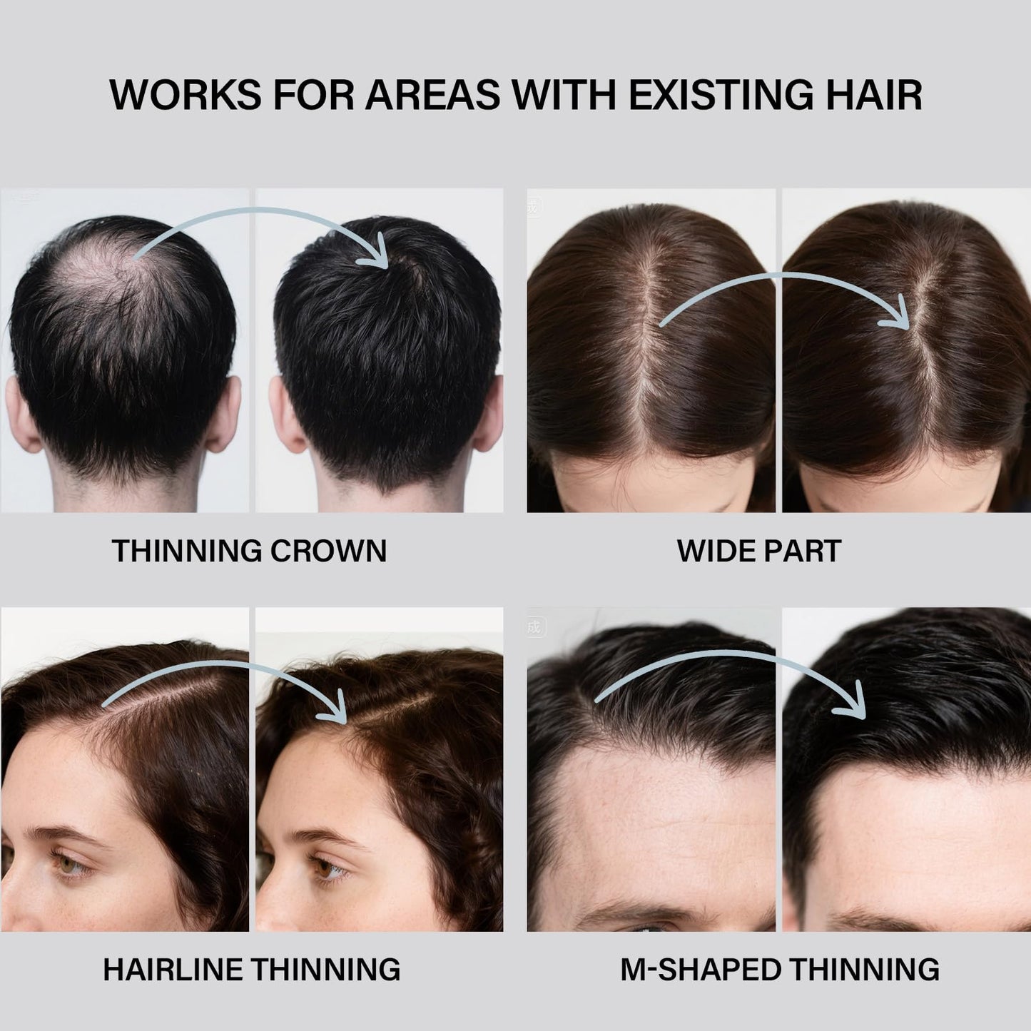Seaboll Hair Building Fibers Kit – 2-in-1 Spray for Thinning Hair (Black)