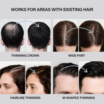 Seaboll Hair Building Fibers Kit – 2-in-1 Spray for Thinning Hair (Black)