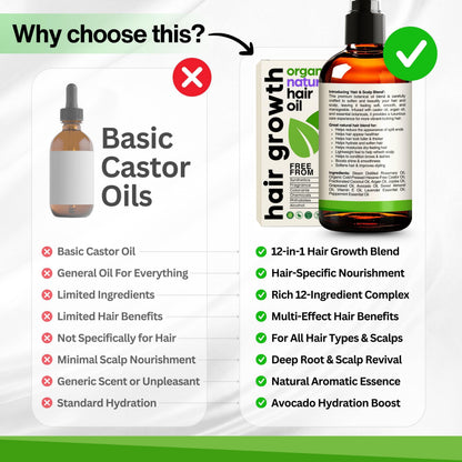 SELFWISE Organic Rosemary Hair Growth Oil with Applicator – 2oz