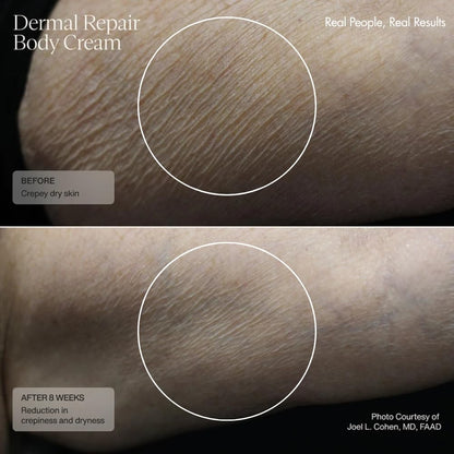 Sente Dermal Repair Body Cream | Restore Skin Barrier, Hydration & Firmer-Looking Skin | 6 oz