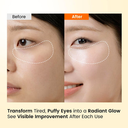 SEONGLOW Caffeine Under Eye Patches – 30 Pairs | Brighten & Hydrate