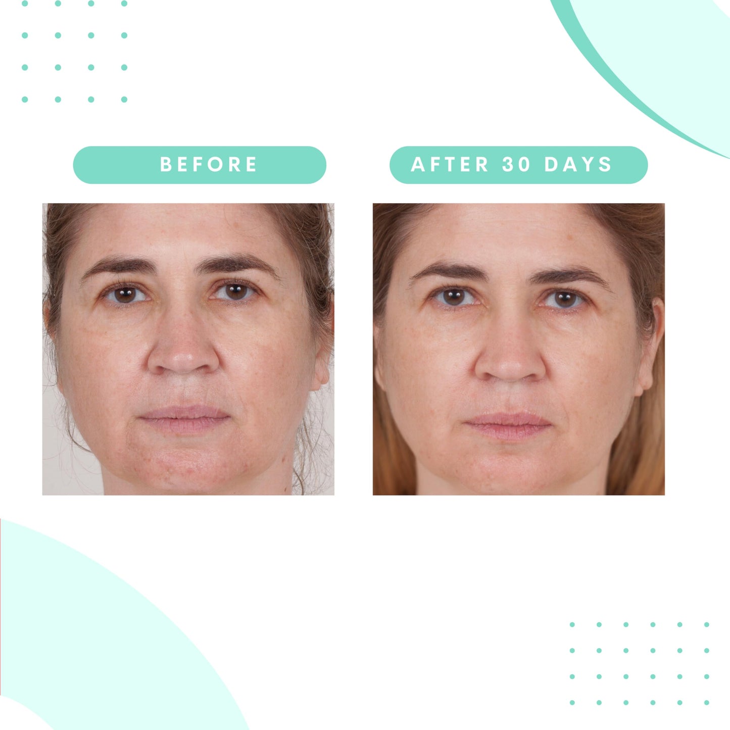 Serious Skincare Glycolic Cleanser – Daily Exfoliating Face Wash with 10% Glycolic