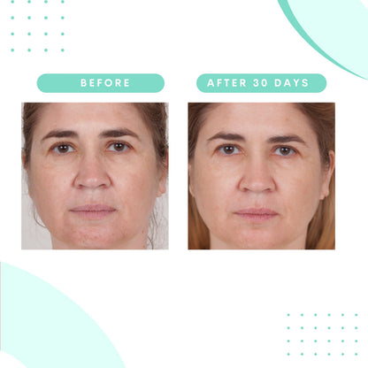 Serious Skincare Glycolic Cleanser – Daily Exfoliating Face Wash with 10% Glycolic