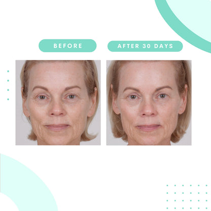 Serious Skincare Glycolic Cleanser – Daily Exfoliating Face Wash with 10% Glycolic
