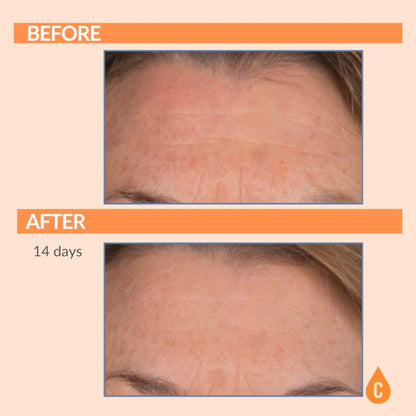 Serious Skincare Vitamin C SPF 30 Broad Spectrum Sunscreen Moisturizer for Face — Hydration, No White Cast
