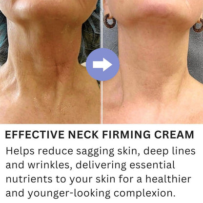 SEWOG Neck Firming Cream - Anti-Wrinkle Neck Moisturizer 1.7 oz