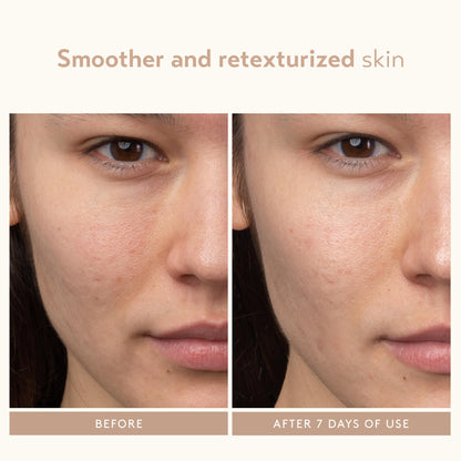SHANI DARDEN Lactic Acid Face Serum | Night Exfoliating Serum for Radiant, Smooth Skin
