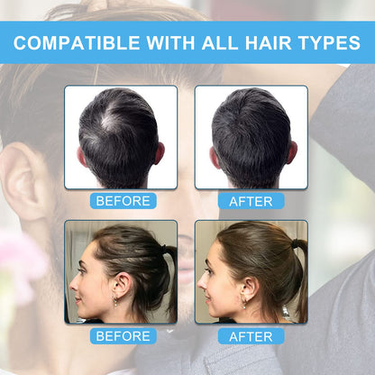 SHIFAKOU Hair Building Fibers with Spray Nozzle – Instant Fuller Hair (Dark Brown, 27.5g, 4 Shades)