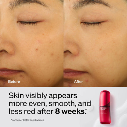 Shiseido Ultimune Power Infusing Serum – 1.6 oz | Lightweight Radiance & Visible Aging Support