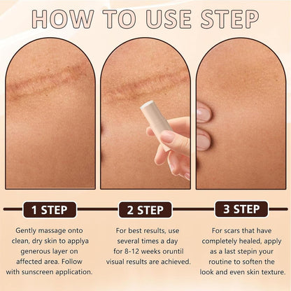 Silicone Scar Stick – 60% Silicone for Face & Body (2 Pack)