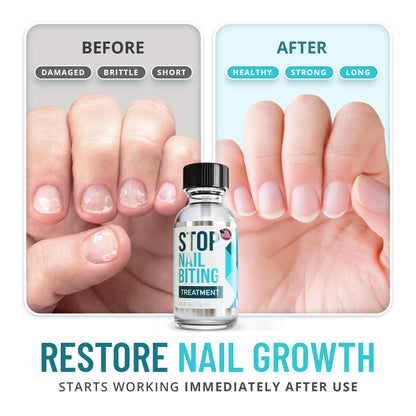 Stop Nail Biting Polish for Kids — Clear Bitter Deterrent, Easy Application (SISQUOC HEALTHCARE, 0.5 fl oz)