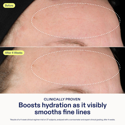Skinfix Triple Lipid-Hyaluronate Serum | Hydrating Facial Serum 1 oz