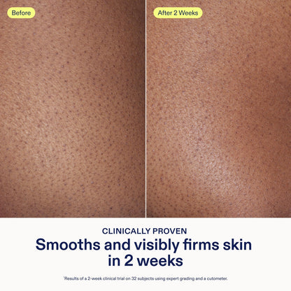 Skinfix AHA/BHA Renewing Body Cream – 10 oz | Gentle Exfoliation & Hydration