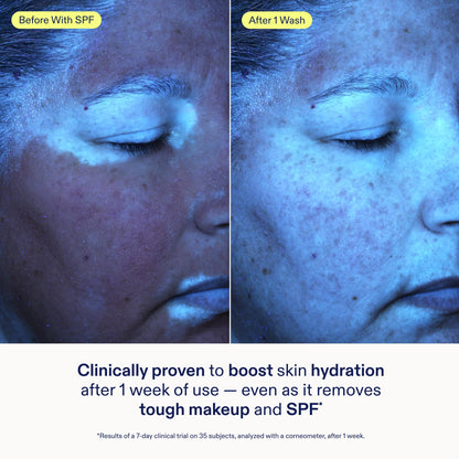 Skinfix Ceramide + Ectoin Gentle Gel Cleanser Mini – Removes Makeup & SPF, Hydrates Skin | Vegan & Cruelty-Free