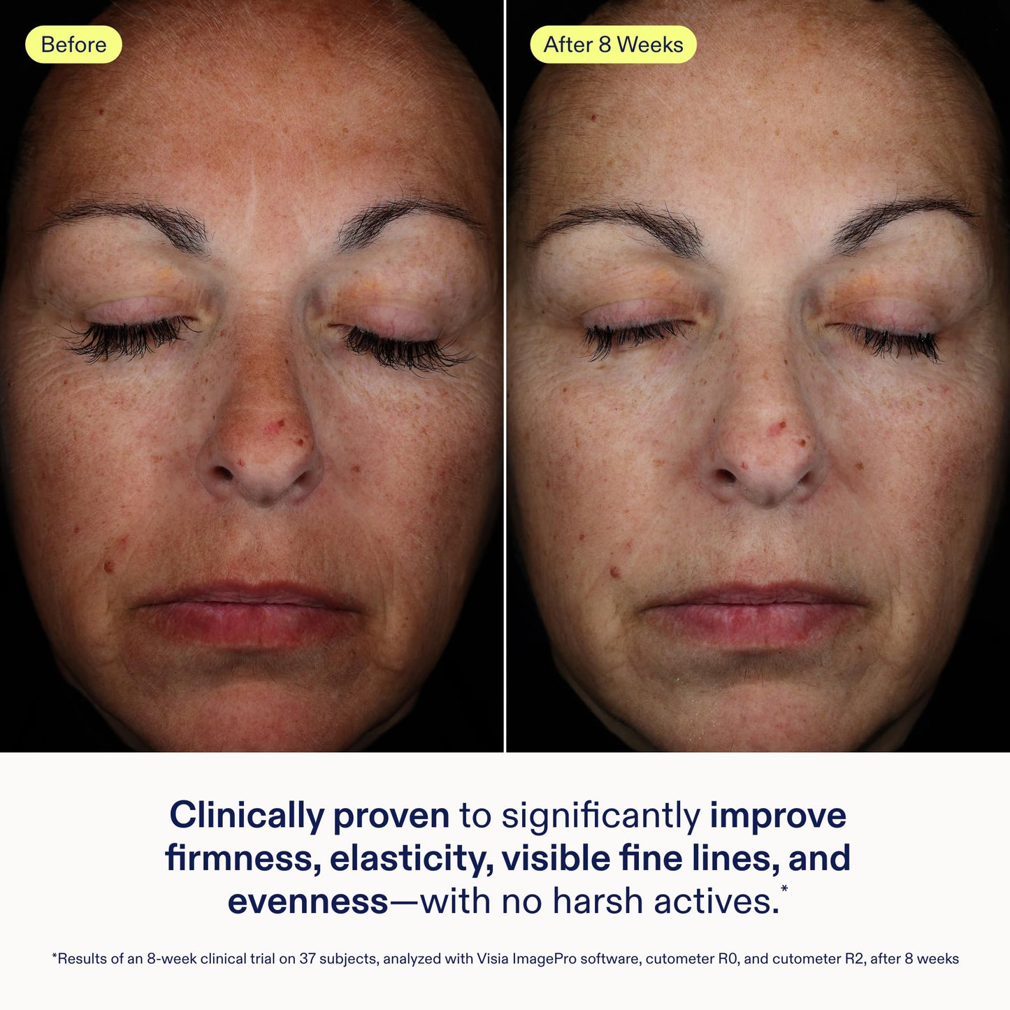 Skinfix Exo + Ectoin Intensive Repair Baume – Retinol-Free Serum with Hyaluronic Acid & Peptides