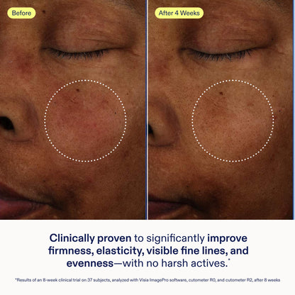Skinfix Exo + Ectoin Intensive Repair Baume – Retinol-Free Serum with Hyaluronic Acid & Peptides