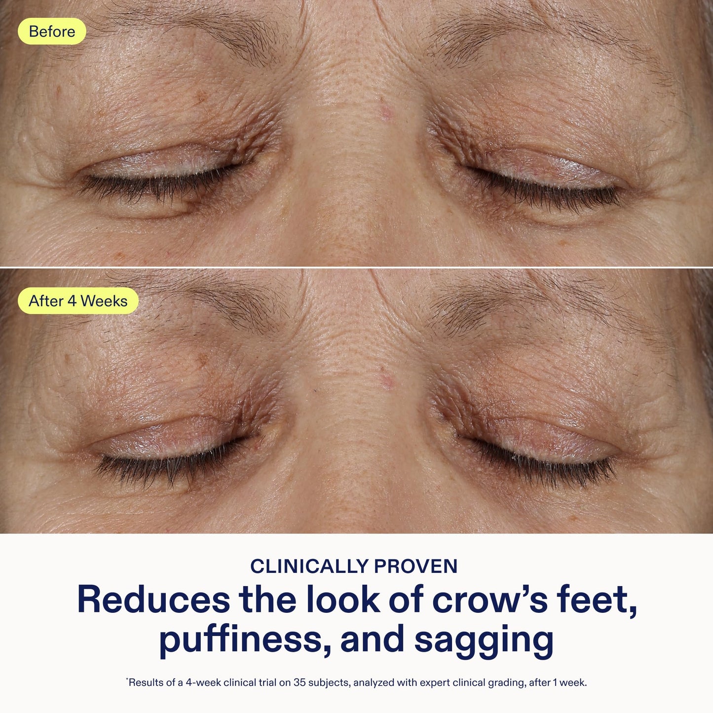 Skinfix Triple Lipid Eye Treatment - 0.5 oz, Fragrance-Free, Vegan Eye Cream