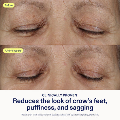 Skinfix Triple Lipid Eye Treatment - 0.5 oz, Fragrance-Free, Vegan Eye Cream