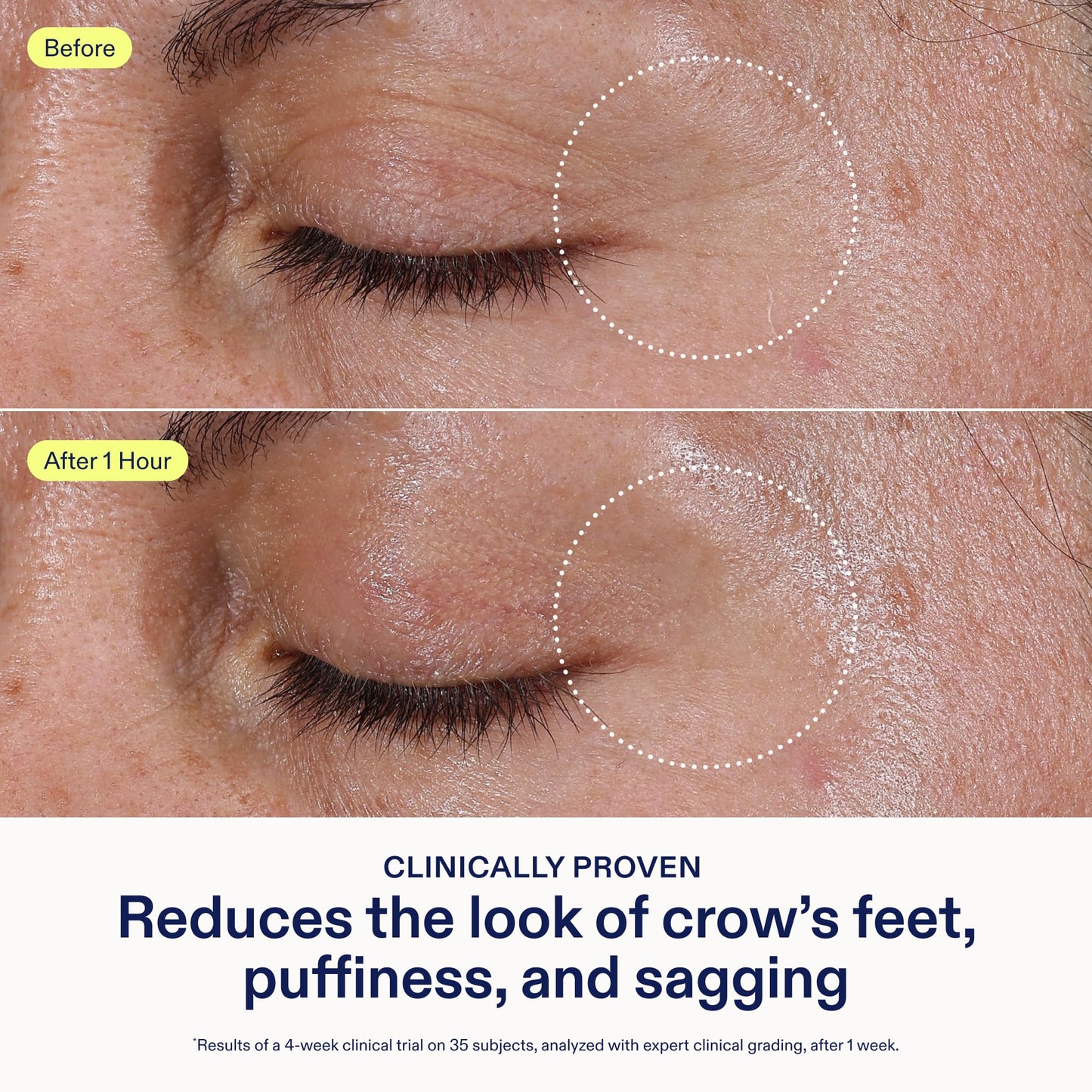 Skinfix Triple Lipid Eye Treatment - 0.5 oz, Fragrance-Free, Vegan Eye Cream