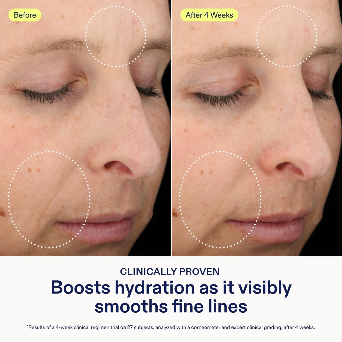 Skinfix Triple Lipid-Hyaluronate Serum | Hydrating Facial Serum 1 oz