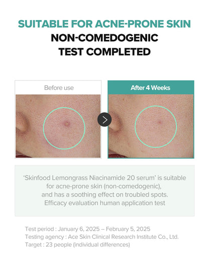 SKINFOOD 1957 Lemongrass Niacinamide 20% Serum — Oily & Sensitive Skin, 50 ml