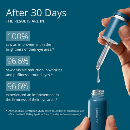 SKINN Caffeine Eye Cream – 30 Day Eye Boot Camp for Dark Circles & Puffiness