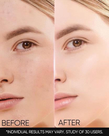 SKINTIFIC MSH Niacinamide Brightening Cream – Even Tone, Dark Spot Fading (100g) with Tranexamic Acid & α-Arbutin
