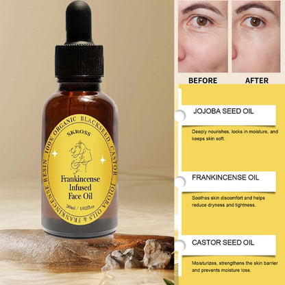 SKROSS Frankincense Resin Oil – Infused Face Oil with Black Seed, Castor & Jojoba (2-Pack)
