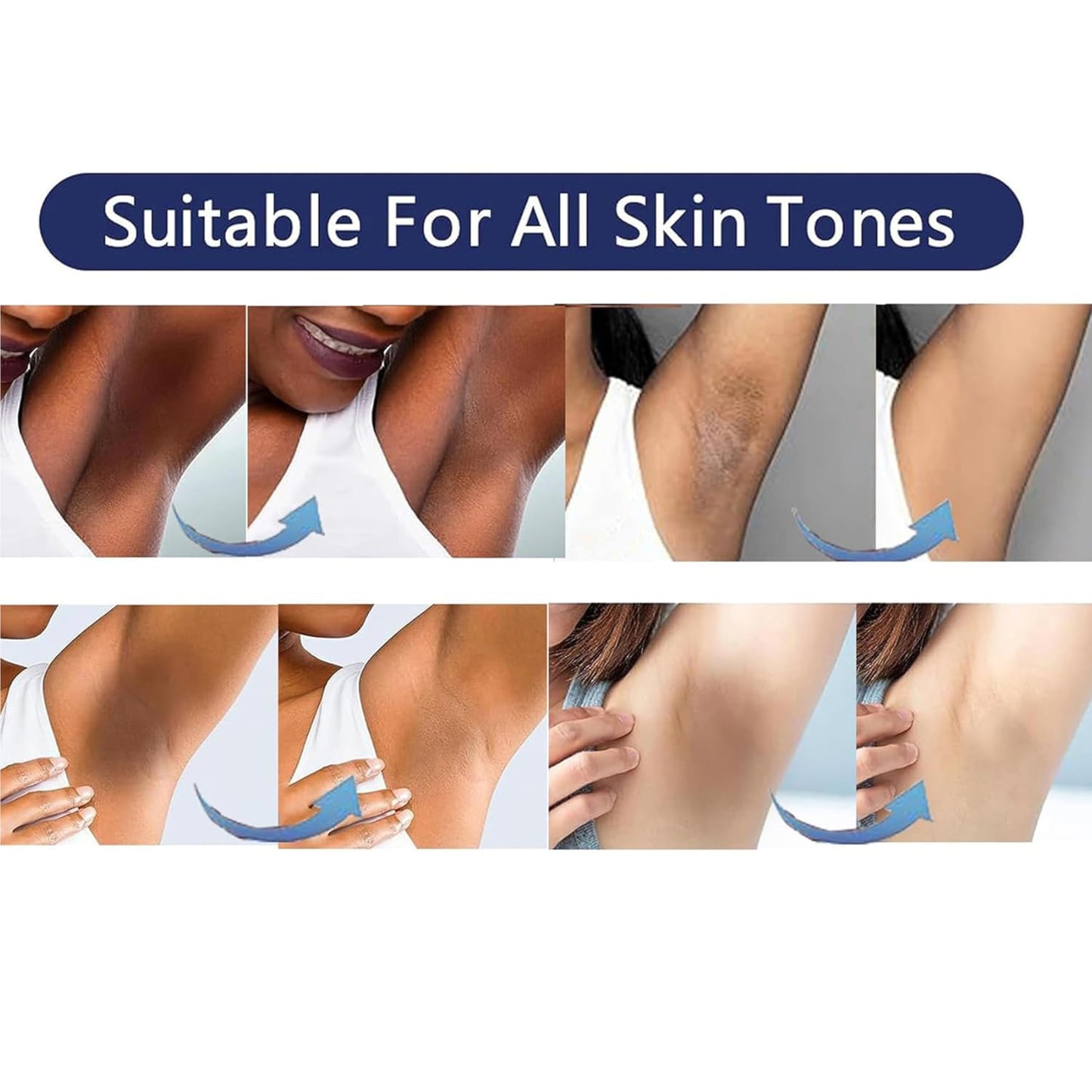 SMILEFACE Intimate Areas Skin Lightening Cream – Gentle Whitening for Private Parts, Underarms, Bikini, Inner Thighs (1.06 FL OZ)