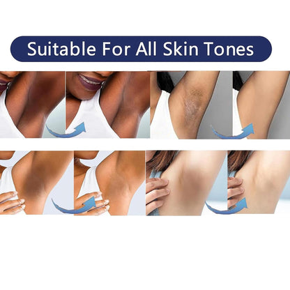 SMILEFACE Intimate Areas Skin Lightening Cream for Private Parts, Underarms & More | Gentle, All-Skin-Tone Safe