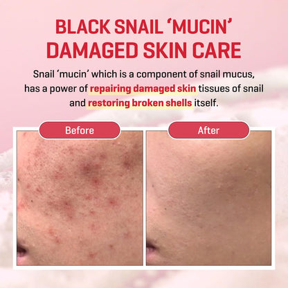 SOME BY MI Snail Trucica Miracle Repair Serum – 50ml for Sensitive Skin & Post-Acne Support | Korean Skincare