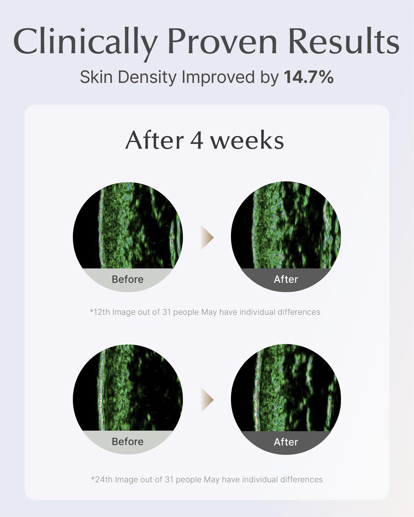 SOORYEHAN Lifting Ampoule Serum – 2.02 fl oz | 5% Niacinamide + Triple Collagen