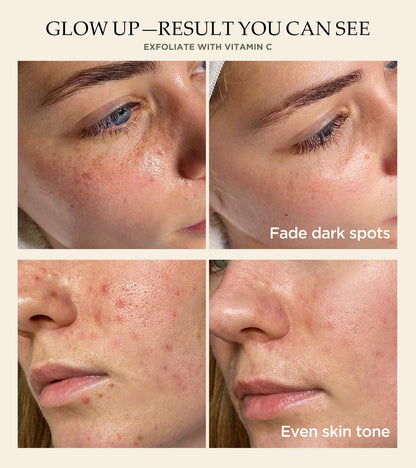 Srripo Revitalizing Exfoliation Face Scrub with Vitamin C & Turmeric | Gentle Daily Facial Polish