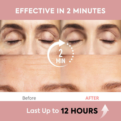 St. Mege Instant Eye & Face Lift Cream — 2-Minute Temporary Firming (1 fl oz)